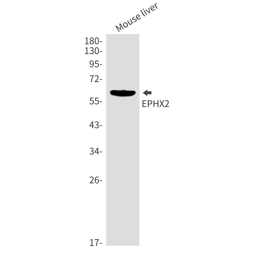 Epoxide Hydrolase 1 Rabbit mAb